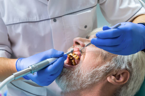 istock Elderly man with yellow teeth. 1474803501