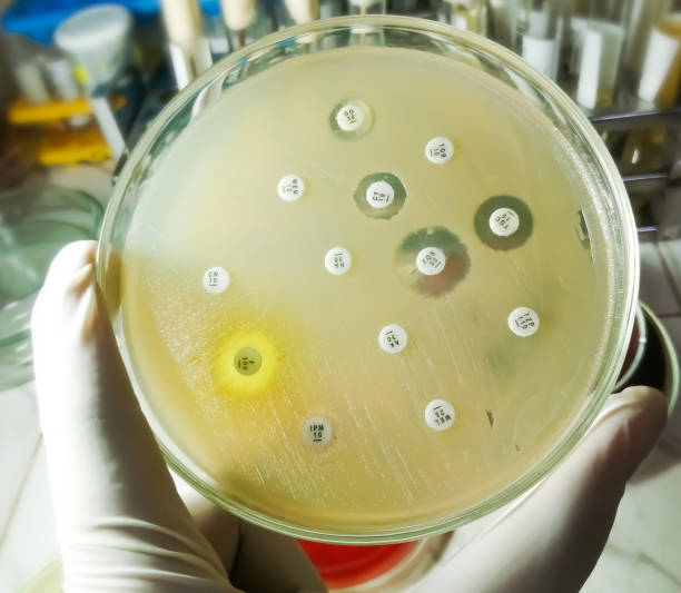 istock Antimicrobial susceptibility testing in petri dish. Antibiotic resistance of bacteria 1474813349