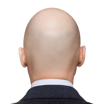 Human alopecia or hair loss - adult man bald head rear or back view