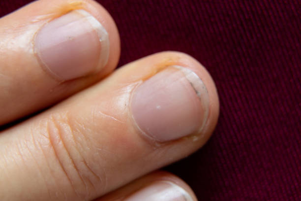 istock fingernail close-up without manicure close up 1474961033