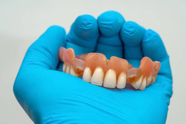 istock A man's hand in a rubber blue glove holds a denture. 1475008918