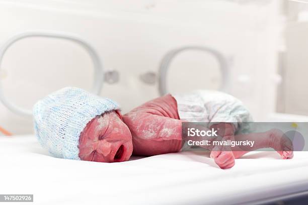 Newborn Baby Covered In Vertix Inside Incubator Stock Photo - Download Image Now - Baby - Human Age, Incubator, Boys