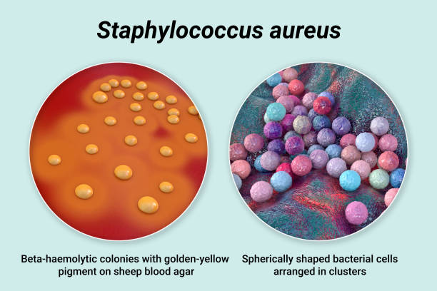 박테리아 황색 포도상 구균, 3d 그림 - bacterium staphylococcus colony epidemic 뉴스 사진 이미지