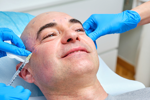 smiling mature man over 40 years old getting anti wrinkle treatment on his face with botulinum toxin