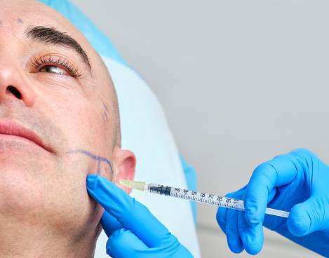 image in which you can see half the face of a man in an aesthetic medicine consultation and hands with gloves injecting botulinum toxin into the face for treatment of bruxism