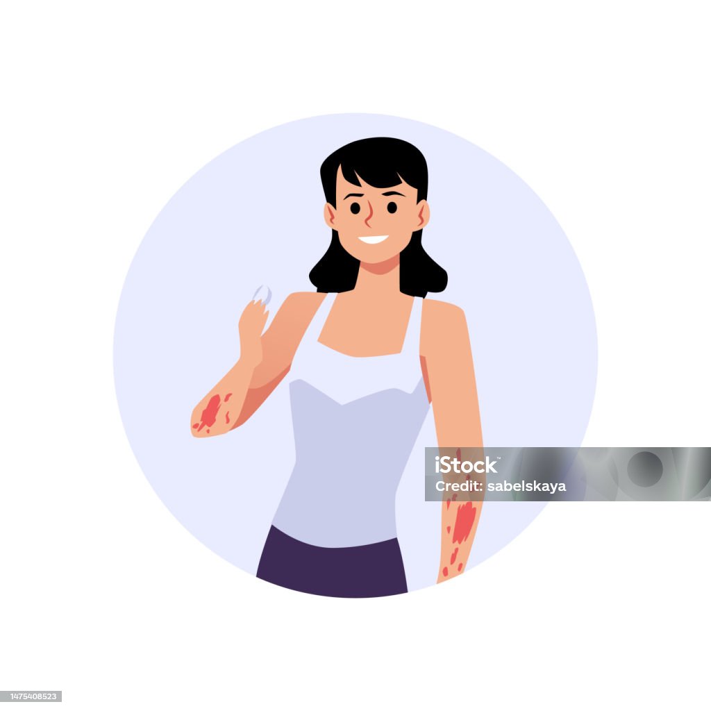 Detratitis Vector Woman Having Atopic Dermatitis Holding Tablet For Treatment Flat Style ...
