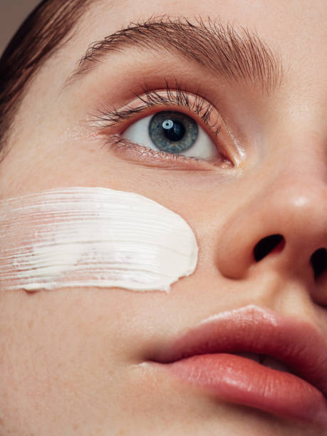 istock Girl inflicting cream 1475464294