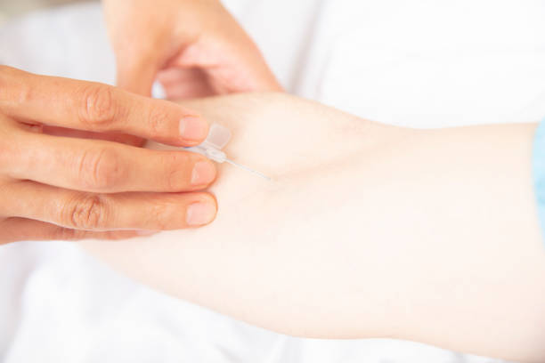 istock Female doctor opens vascular access to patient 1475608256