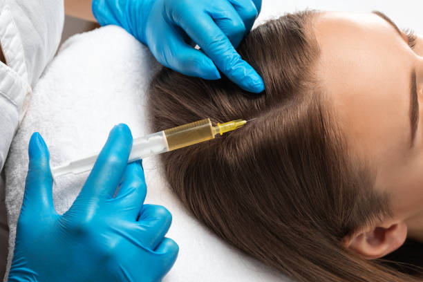 Cosmetologist does injections therapy against hair loss and anti-dandruff of a beautiful woman in a beauty salon. Cosmetology concept. stock photo