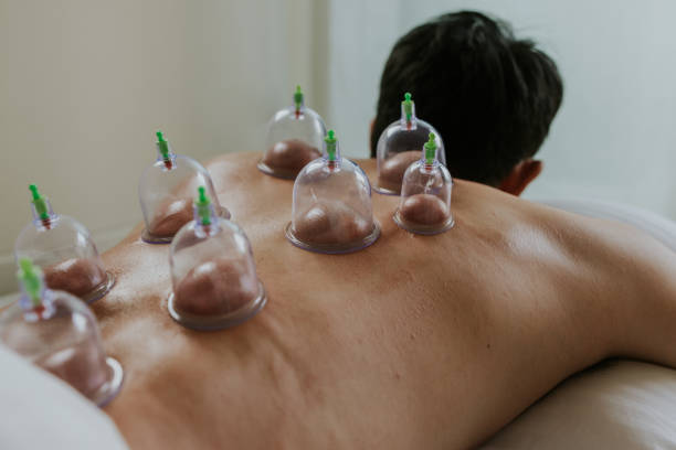 Asian officer man treating his back pain with Chinese cupping therapy. Asian man lying down and treating his back pain with vacuum cupping therapy. cupping therapy stock pictures, royalty-free photos & images