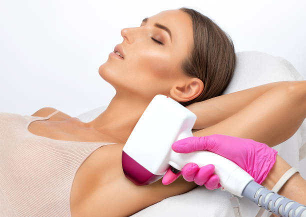 Elos epilation, hair removal procedure on a womans body. Beautician doing laser rejuvenation in a beauty salon. Removing unwanted body hair. Hardware ipl cosmetology stock photo