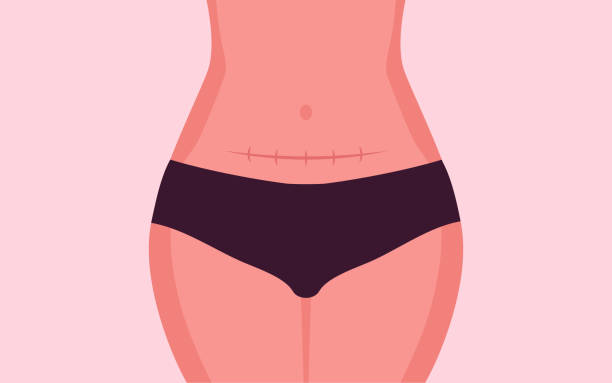 cesarskie cięcie - stomach the human body abdomen human digestive system stock illustrations