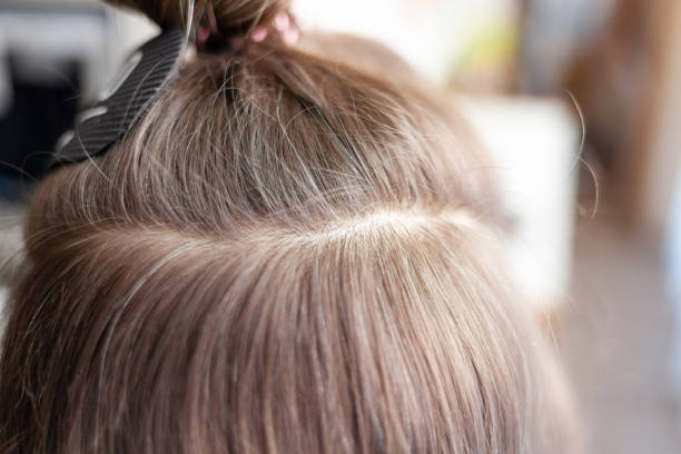 istock Hair ribbons for extensions on a woman's head at home. 1475872012