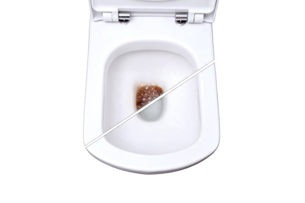 istock Unclogging toilet dirt. Before and after fixing the blockage problem, isolated on a white background 1476021887