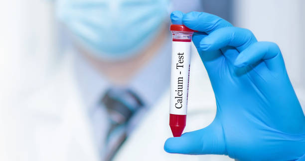 istock Doctor holding a test blood sample tube with calcium test. 1476243364