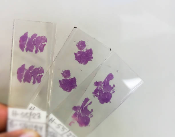istock Histopathology slides stained with hematoxylin and eosin or HE stain. 1476362438