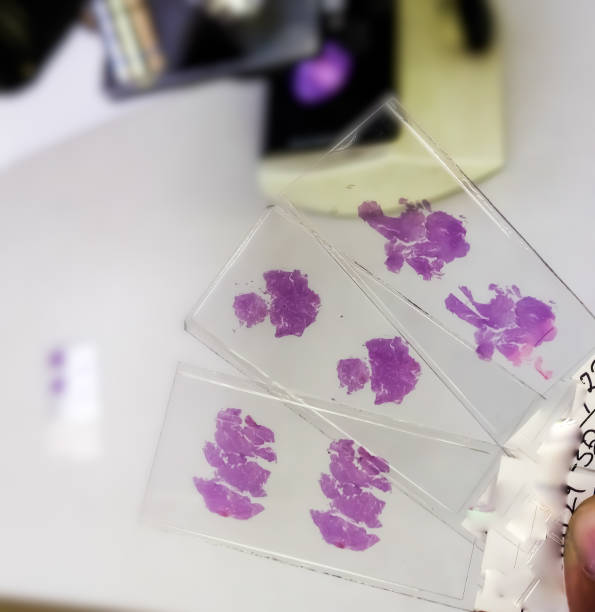 Histopathology slides stained with hematoxylin and eosin or HE stain. Close view of Histopathology slides stained with hematoxylin and eosin or HE stain, ready for microscopic examination with Laboratory background, Histology. 1814 stock pictures, royalty-free photos & images