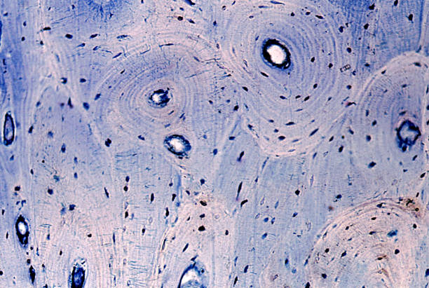 hueso. osteonas y laminillas intersticiales - sistema de havers fotografías e imágenes de stock