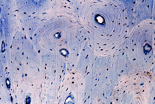 Light micrograph of compact bone. Osteons are rounded or oval structures, made up of bony lamellae arranged concentrically around a small duct called (Haversian duct). Between the lamellae are the oval bodies of the osteocytes. Among the osteons there are groupings of bone lamellae called interstitial lamellae, which are the remnants of osteons that were partially resorbed during the process of bone remodeling.