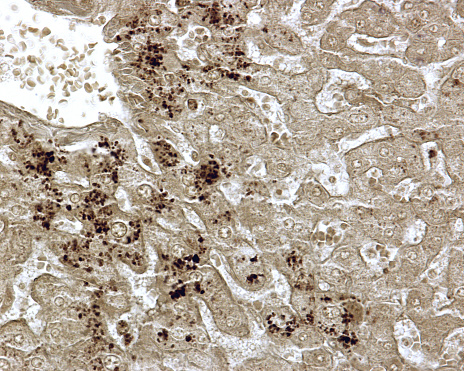 The normal liver cells or hepatocytes contain lipid droplets, more frequent near the central vein of hepatic lobules, that can be demonstrated using osmium tetroxide as fixative. In steatosis or fatty liver disease, the amount of lipid droplets is pathologically very increased.