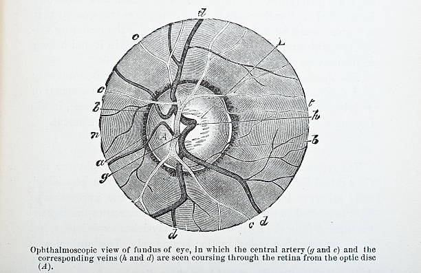 Ophthalmoscopic View http://thebrainstormlab.com/banners/ami_banner.jpg medical diagram photos stock illustrations