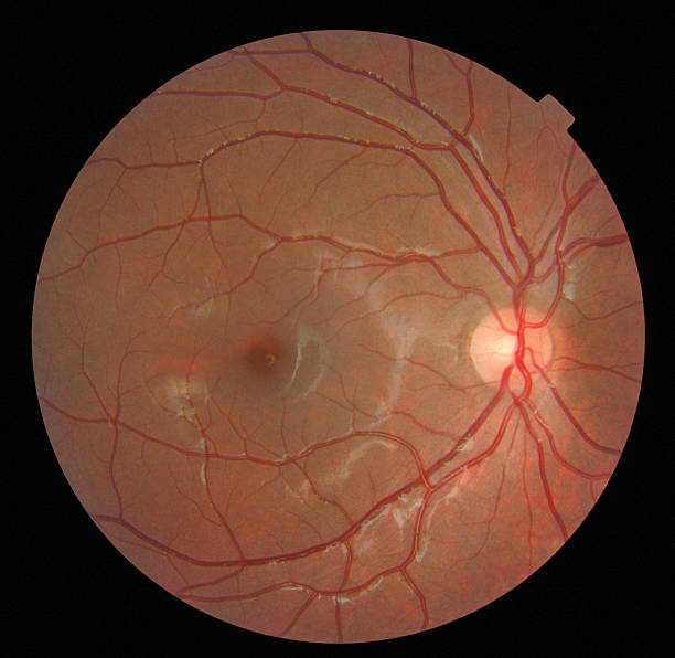 istock Close-up image of a retina against black background 147659033