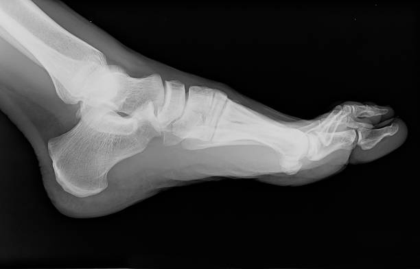 X-Ray Left Foot Inside View stock photo