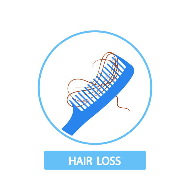 kuvapankkikuvitukset aiheesta hiuskampa, jossa on harjasten sisään sotkeutuneita hiussäikeitä, mikä osoittaa hiustenlähtöä tai vaurioita. mainosta hiustenhoitotuotetta - receding hairline
