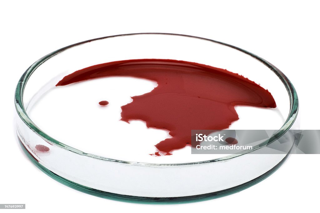 Piastra Petri con il sangue - Foto stock royalty-free di Attrezzatura