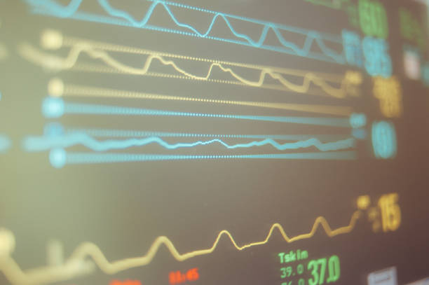 istock ECG Monitor 1477026927