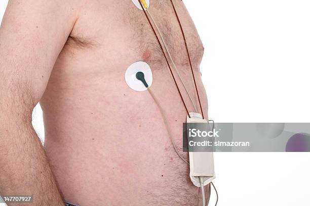 El Electrocardiograma Foto de stock y más banco de imágenes de Latido cardíaco - Latido cardíaco, Adulto, Arritmia cardíaca