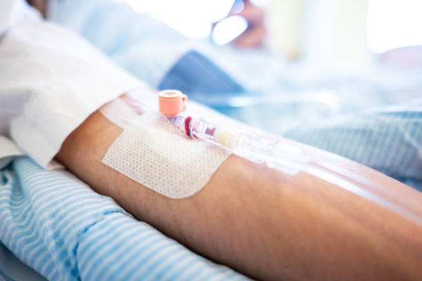 istock Venous catheter on a patient before an operation. 1477250584