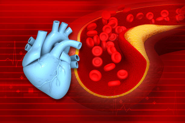 istock Cholesterol blocked artery with human brain 1477426501