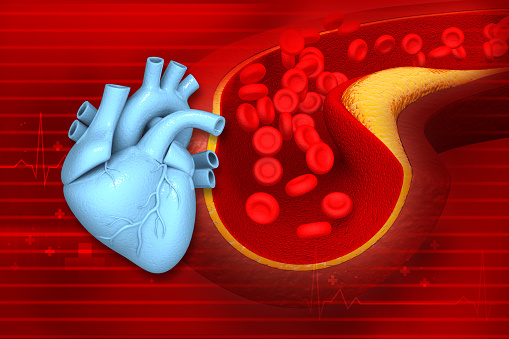 Cholesterol blocked artery with human brain. 3d illustration