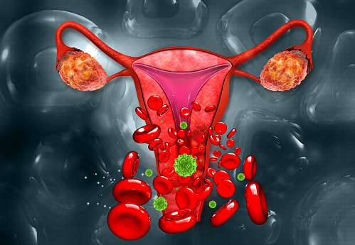 Anatomy of uterus , uterus infection. 3d illustration