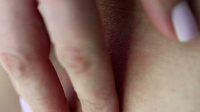 Hand scratching itchy skin rash after mosquito bite closeup 4k movie slow motion