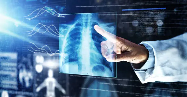 Photo of Doctor, healthcare or finger on xray hologram in tuberculosis virus, cancer analytics or asthma x ray at night. Futuristic, abstract or medical lungs scan for surgery planning or hospital woman help