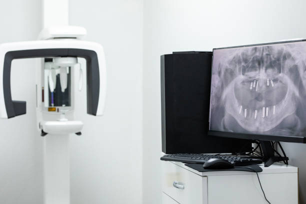 istock x-ray machine and implant treatment, health and technology 1477520537