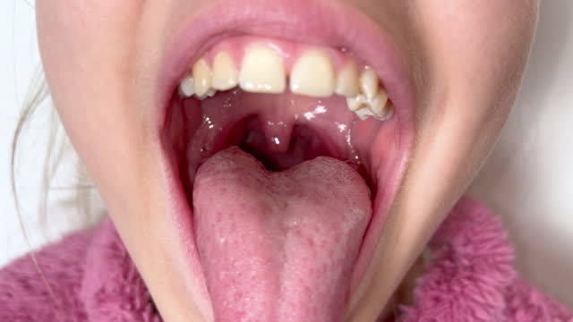Child girl or teenage girl of eleven years old opens the mouth wide and shows the teeth, gums and throat the doctor. Concept of orthodontics, dental health, braces, otolaryngologist