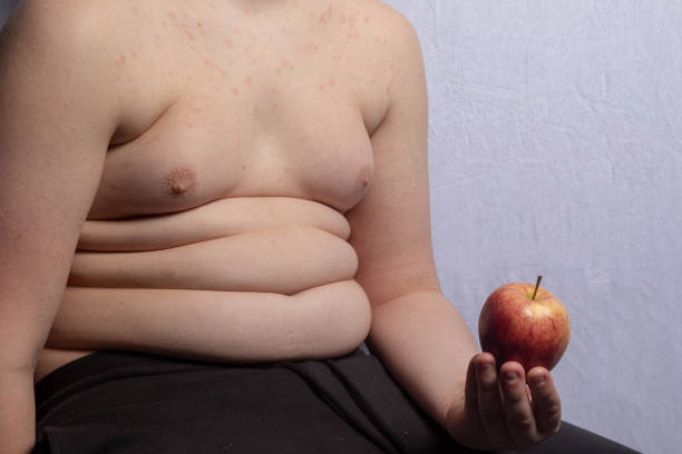 an overweight teenage boy with an apple - child obesity imagens e fotografias de stock