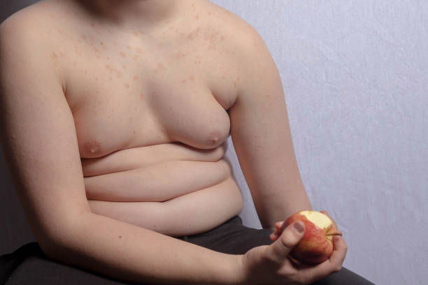 istock An overweight teenage boy with an apple 1477804849