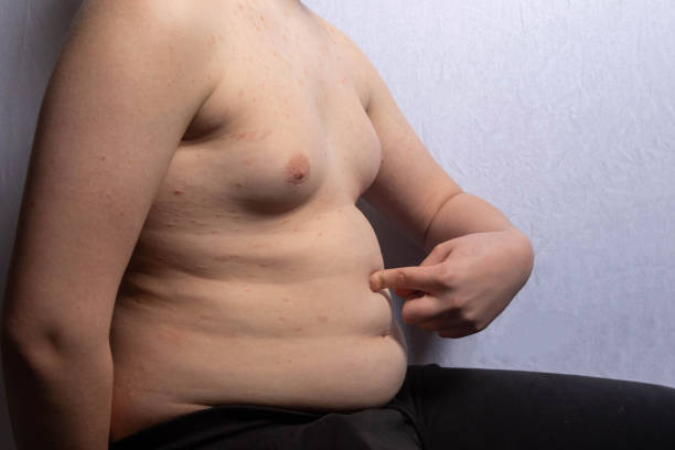istock An overweight teenage boy sitting 1477806190