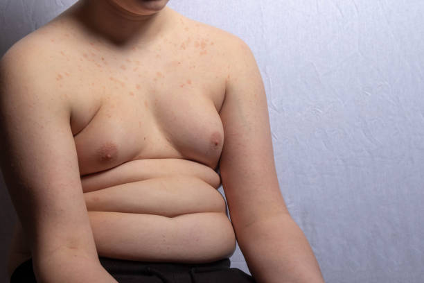 istock An overweight teenage boy sitting 1477806801