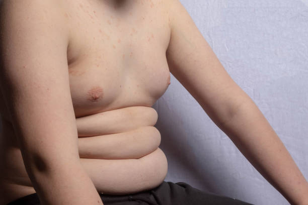 istock An overweight teenage boy sitting 1477807437