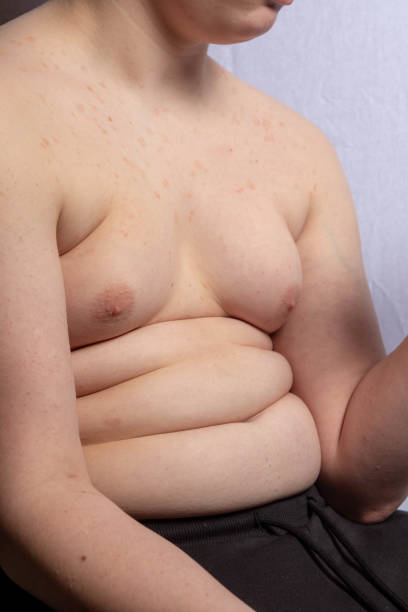 istock An overweight teenage boy sitting 1477808599