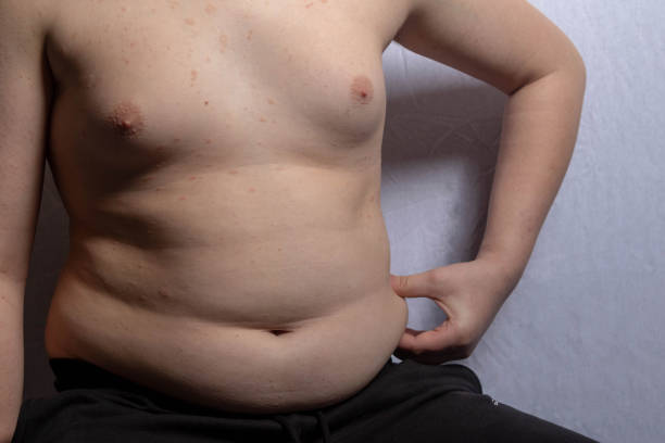 istock An overweight teenage boy sitting 1477811905