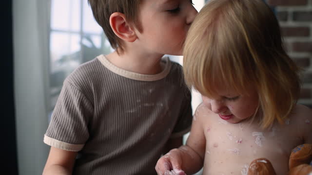 Little boy kisses his ill sister with chickenpox