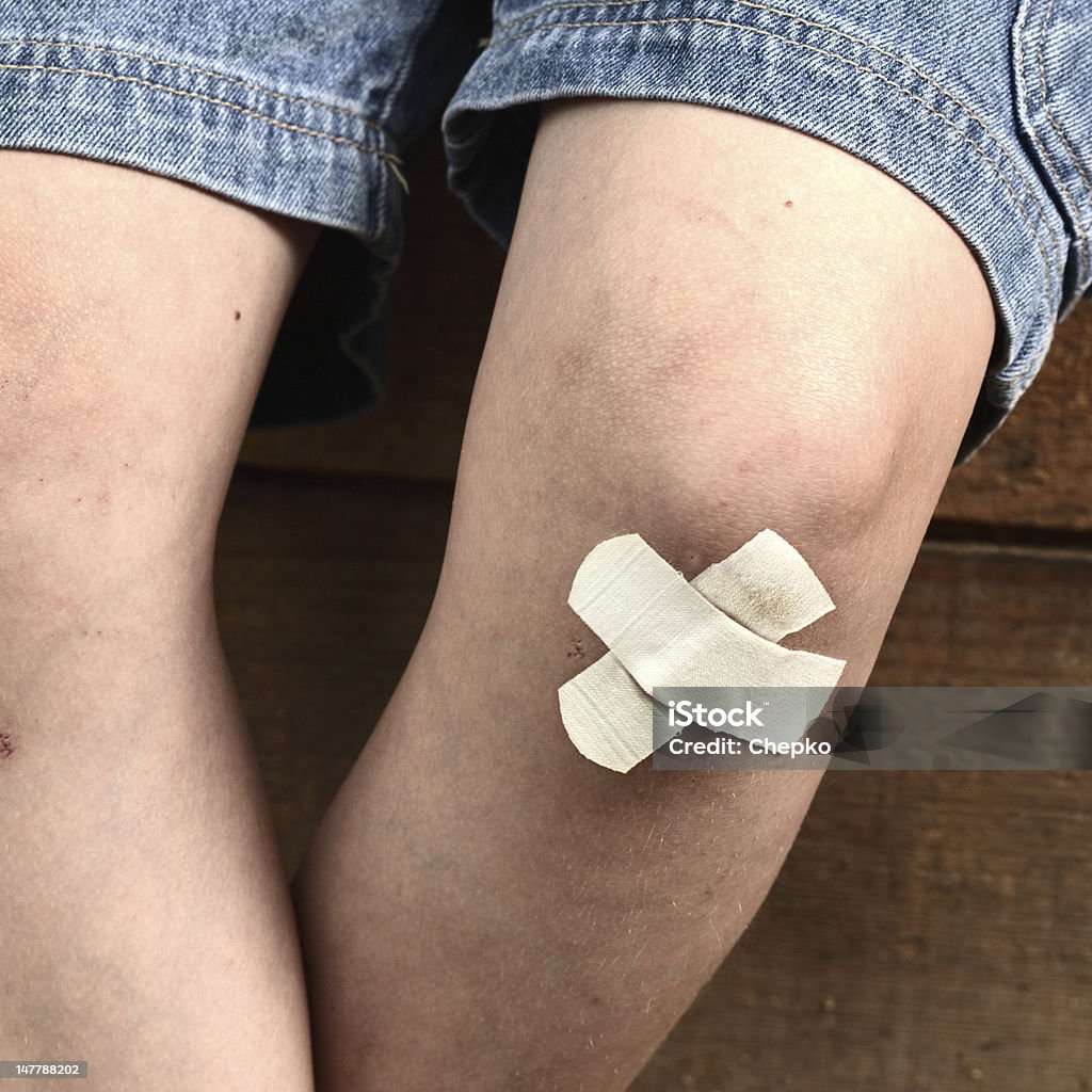 bruise on the boy's leg Boys Stock Photo