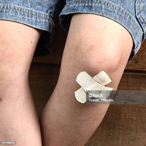 Bruise On The Boys Leg Stock Photo - Download Image Now - Boys, Child, Childhood