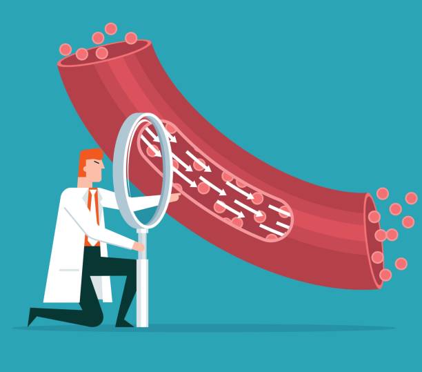 szkło powiększające - naczynie krwionośne - human artery cholesterol atherosclerosis human heart stock illustrations